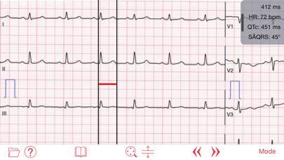 Photo EKG App screenshot #1