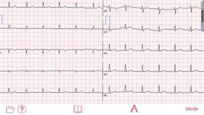 Photo EKG screenshot