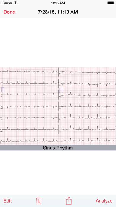 Photo EKG App screenshot #4