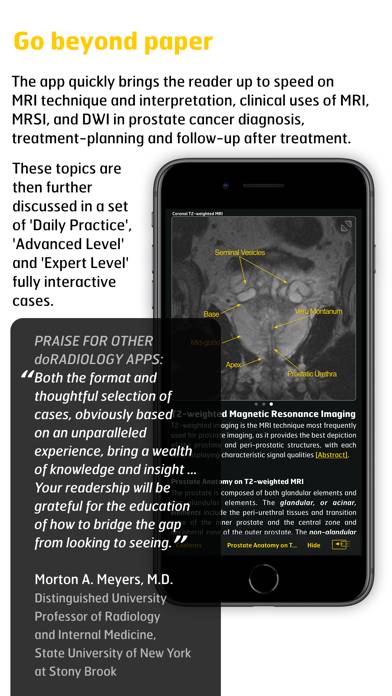 MR Imaging in Prostate Cancer captura de pantalla