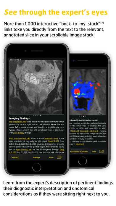 MR Imaging in Prostate Cancer Captura de pantalla de la aplicación