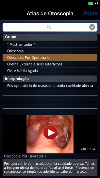 Atlas de Otoscopia App screenshot #3