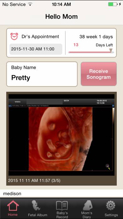 Hello Mom for Samsung Medison App screenshot #1