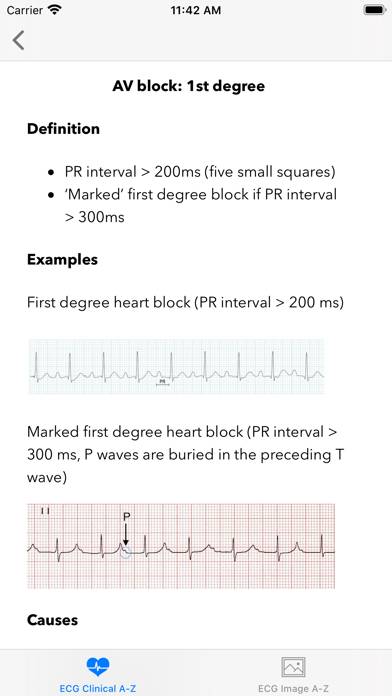 ECG A-Z Pro App screenshot