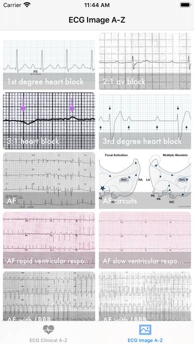 ECG A-Z Pro App screenshot