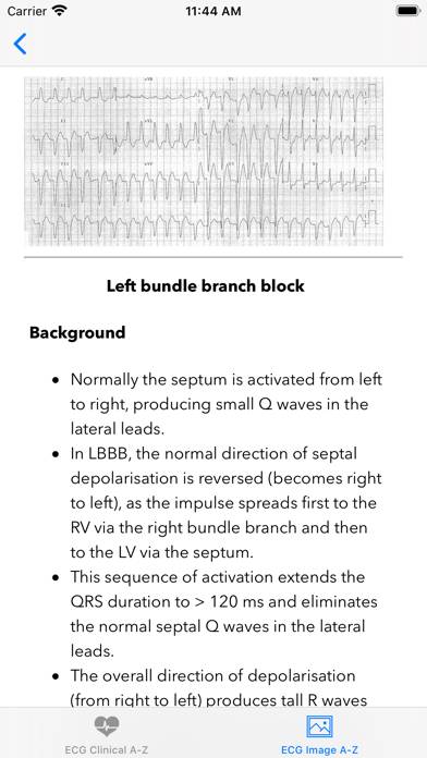 ECG A-Z Pro App screenshot