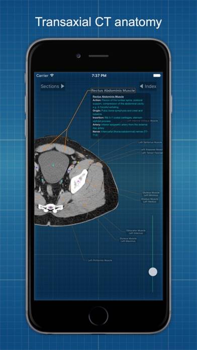 X-Anatomy Basic App skärmdump