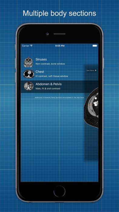 X-Anatomy Basic App screenshot