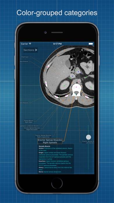 X-Anatomy Basic App skärmdump