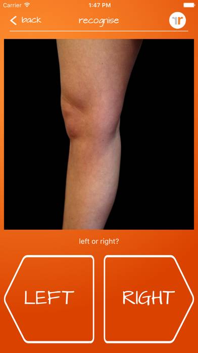 Recognise Knee App-Screenshot #2