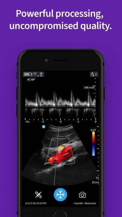 Vscan Air Wireless Ultrasound Captura de pantalla de la aplicación #5