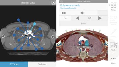 Human Anatomy Atlas 2024 App skärmdump #5