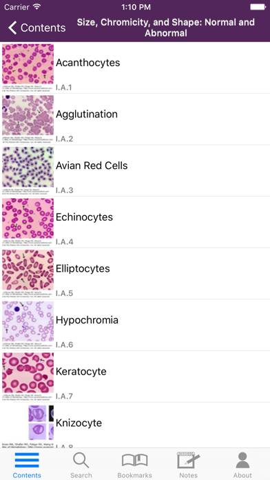 Lichtman's Atlas of Hematology App screenshot #3