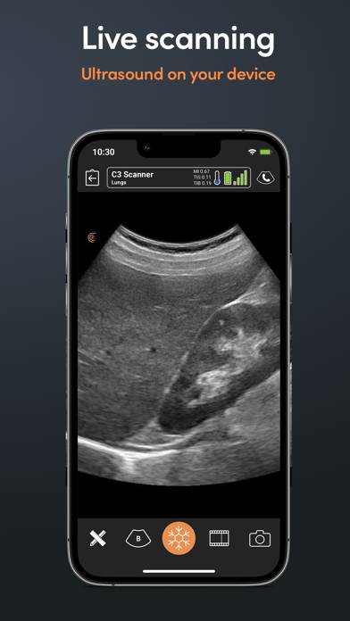 Clarius Ultrasound App screenshot
