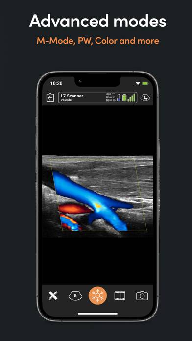 Clarius Ultrasound App Uygulama ekran görüntüsü #4