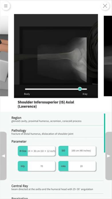 Navi Radiography Pro App screenshot #4