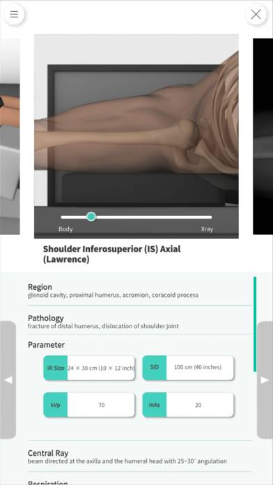 Navi Radiography Pro App screenshot #5