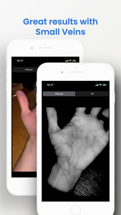 VeinSeek Pro Captura de pantalla de la aplicación #4