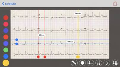 Ekgfy Schermata dell'app