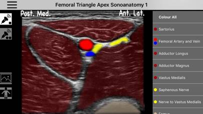 AnSo Anaesthesia Sonoanatomy Captura de pantalla de la aplicación #1