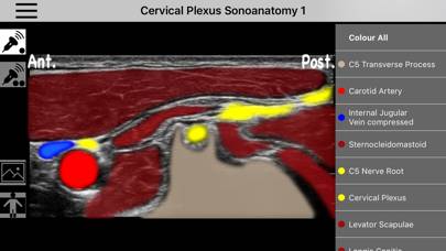AnSo Anaesthesia Sonoanatomy Captura de pantalla de la aplicación #5