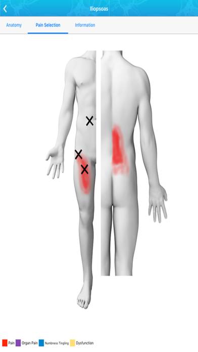 Referred Pain Index App screenshot