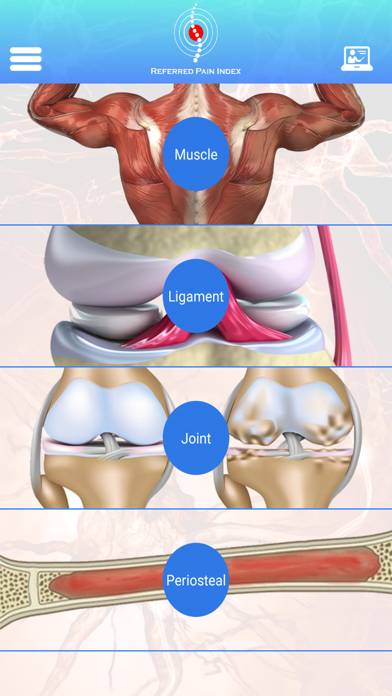 Referred Pain Index App screenshot