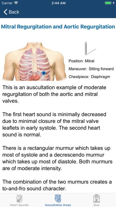 Heart Sounds Auscultation App screenshot #6