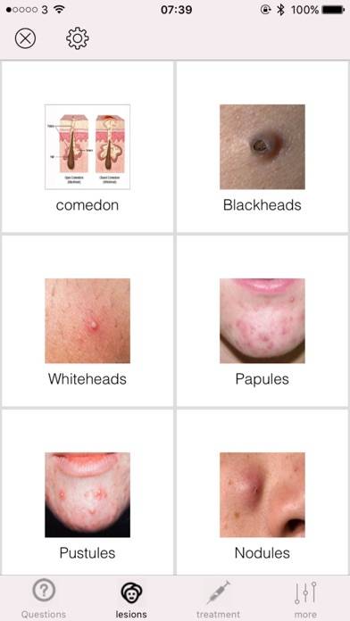 Acne Schermata dell'app