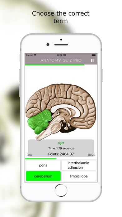 Anatomy Quiz Premium App skärmdump #5
