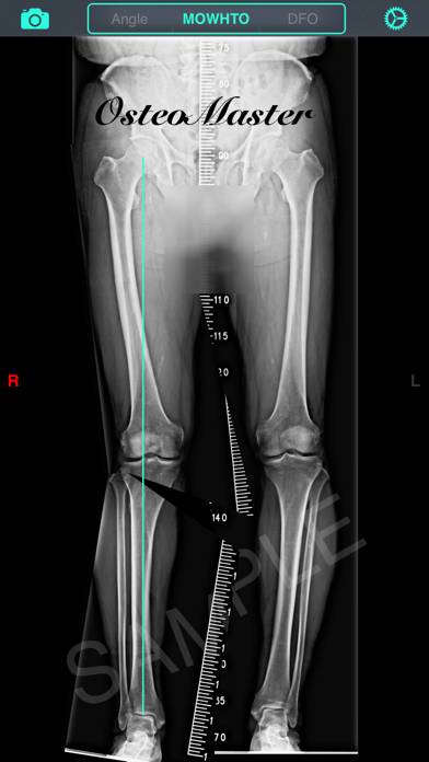 OsteoMaster Schermata dell'app