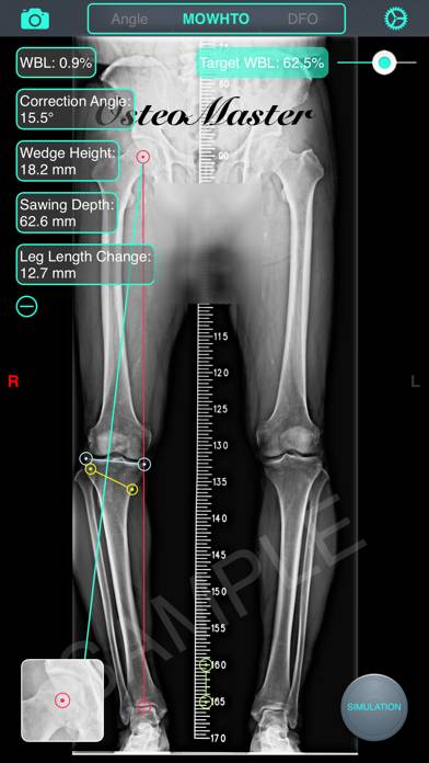 OsteoMaster immagine dello schermo