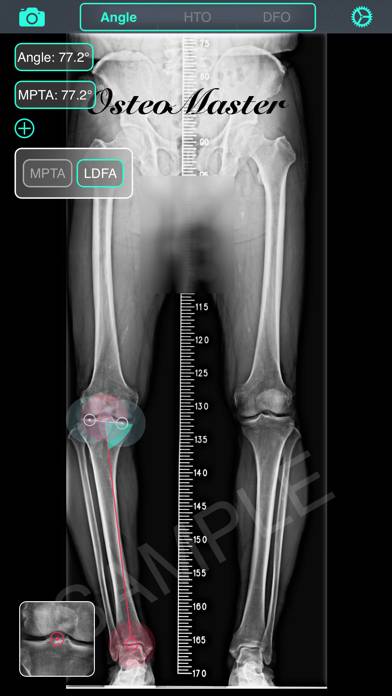 OsteoMaster Schermata dell'app