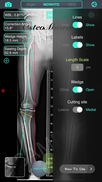 OsteoMaster Schermata dell'app