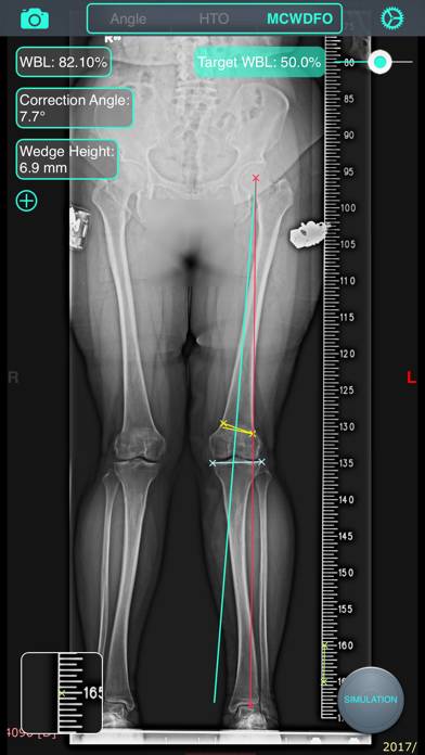OsteoMaster Schermata dell'app