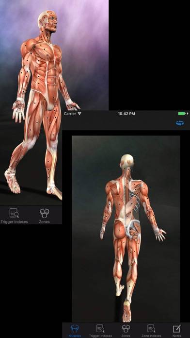 Muscle Trigger Points: Guide & Reference Captura de pantalla de la aplicación #1