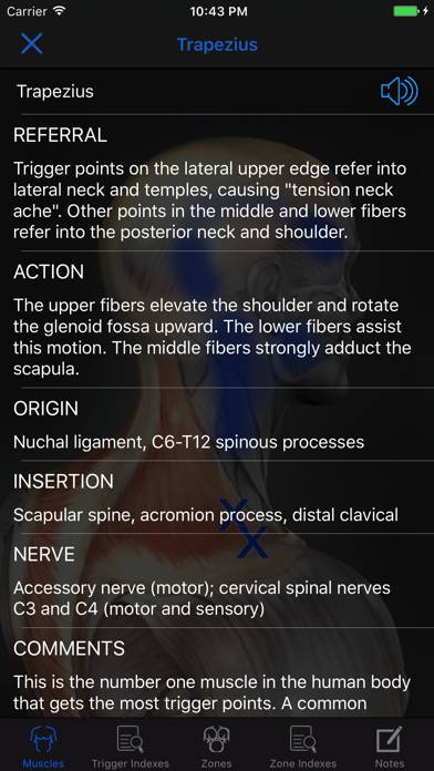 Muscle Trigger Points: Guide & Reference Captura de pantalla de la aplicación #2