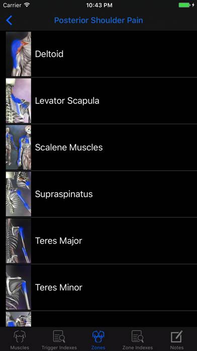 Muscle Trigger Points: Guide & Reference Captura de pantalla de la aplicación #4