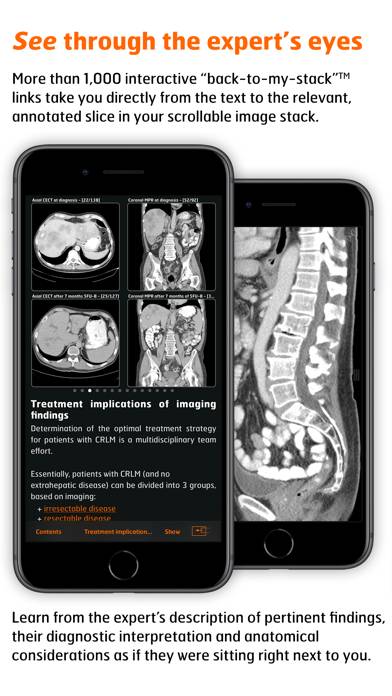 Radiology Captura de pantalla de la aplicación