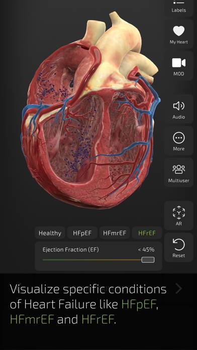 Insight Heart App skärmdump #4