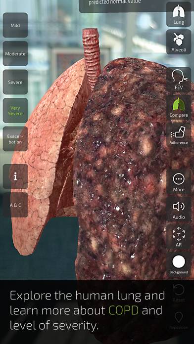Insight Lung App-Screenshot #3