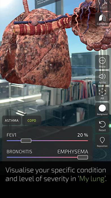 Insight Lung App-Screenshot #6