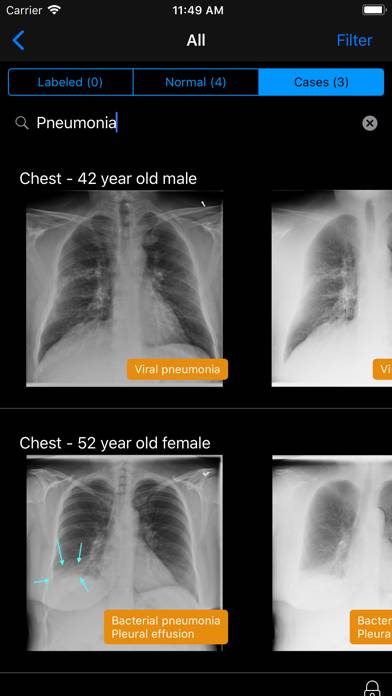 Normal X-Rays and Real Cases App screenshot #3