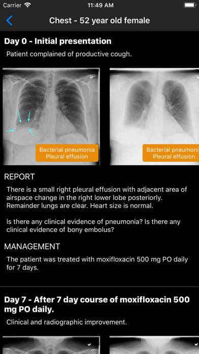 Normal X-Rays and Real Cases App screenshot #4