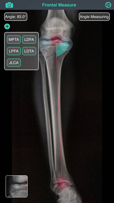 OsteoGauge Captura de pantalla de la aplicación #2