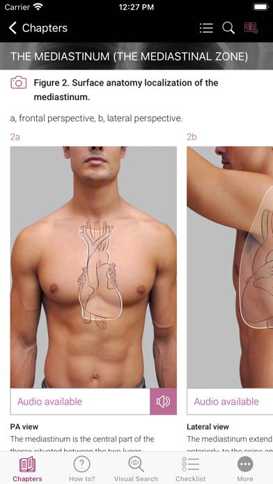 Chest X-ray Interpretation App screenshot #2