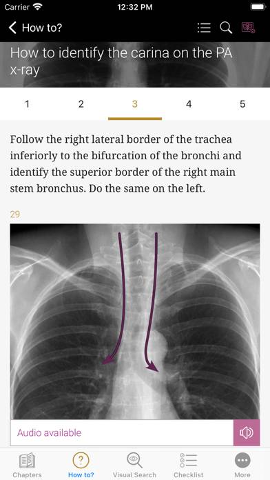 Chest X-ray Interpretation App screenshot