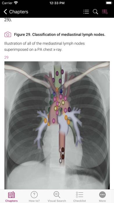 Chest X-ray Interpretation App screenshot #5