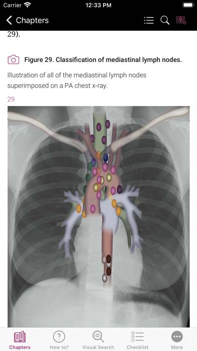 Chest X-ray Interpretation App screenshot