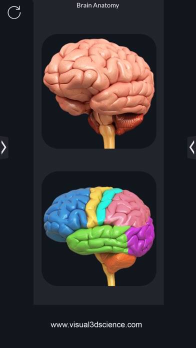 My Brain Anatomy App screenshot